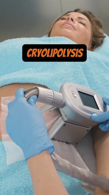 𝐒𝐭𝐮𝐛𝐛𝐨𝐫𝐧 𝐟𝐚𝐭 𝐭𝐡𝐚𝐭 𝐝𝐨𝐞𝐬𝐧’𝐭 𝐬𝐞𝐞𝐦 𝐭𝐨 𝐠𝐨 𝐚𝐰𝐚𝐲? ❄️✨

Cryolipolysis is a 