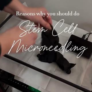 Stem cell microneedling for hair loss, and yes, it’s as incredible as it sounds. 🌿

Here’s what’s a