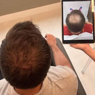 Só fica careca quem quer! Dividindo com vocês mais um resultado incrível! Tratamento médico clínico 