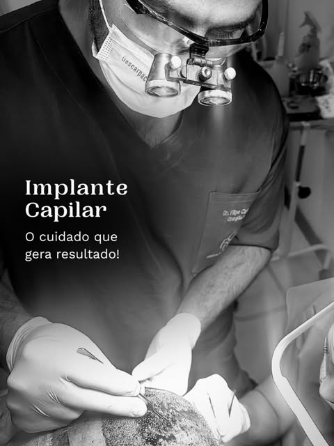 Implante capilar: a precisão que transforma.

Cada etapa de um transplante capilar exige dedicação t