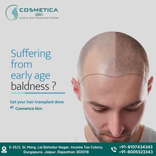 ✨✂️ Unlock confidence with a transformative Hair Transplant experience at Cosmetica Skin Clinic, Jai