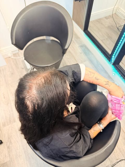 Dealing with alopecia can feel like losing a piece of your confidence and your everyday glow. But yo