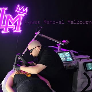 We are proud to announce the launch of Luxe Micro Laser Removal. Please follow our other page @luxem