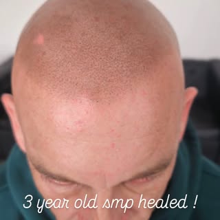 Healed 3 year old smp. Client came back for a touch up to give it some pop ! 

For free consultation