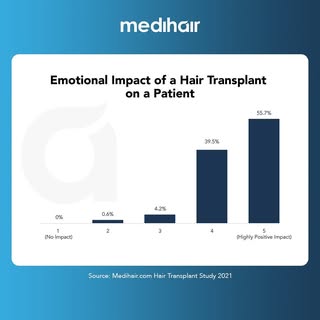The vast majority of patients who receive a hair transplant experience a dramatic, positive emotiona