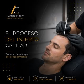 El injerto capilar es un proceso que requiere planificación, precisión y seguimiento en cada etapa.
