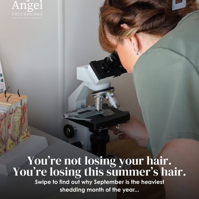 Some people notice more hair loss at the end of Summer - a little bit more on your brush is one thin
