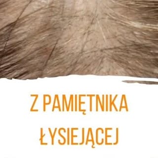 Włosy. Tylko włosy. Aż włosy.
Około 2015r. pierwszy raz spojrzałam podejrzliwie na swój przedziałek 