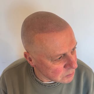 Have you heard of SMP? 🤔

This non-invasive hair loss solution is for everyone. 😆

Check out these