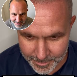 This isn’t just a treatment.
It’s an experience.

From his first consultation to the final session, 