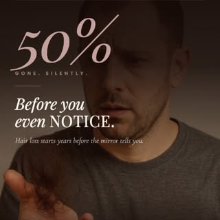 Healthy hair starts with the right treatment at the right stage ✨
PRP and GFC therapies help slow ha