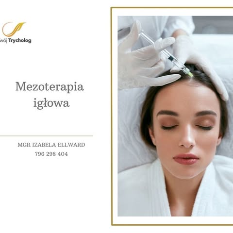 Mezoterapia igłowa jest obecnie jednym z najskuteczniejszych zabiegów w walce z łysieniem, nadmierny