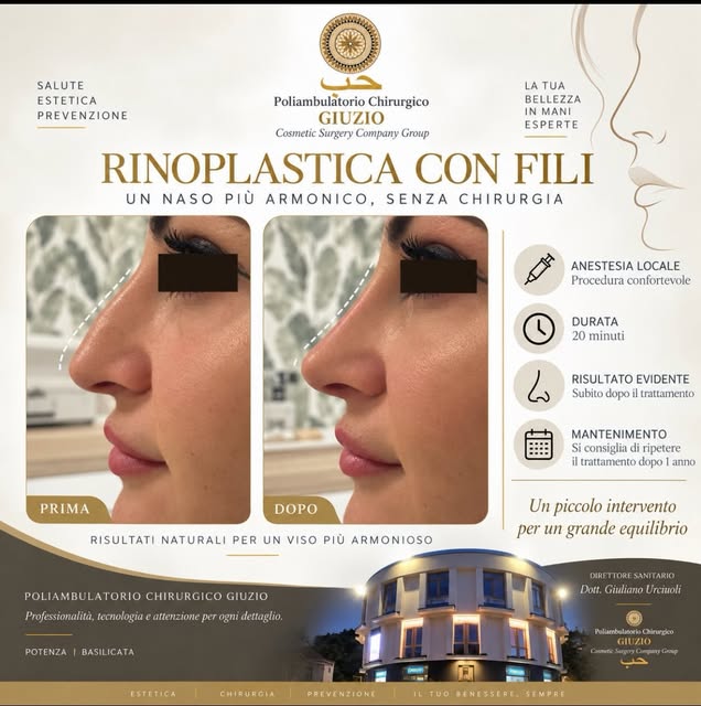 ✨ RINOPLASTICA CON FILI

Un trattamento mini-invasivo pensato per armonizzare il profilo del naso e 
