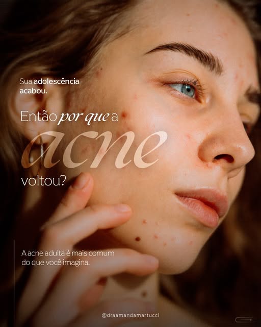 Oscilações hormonais, estresse, genética, medicamentos e outros fatores podem estar envolvidos, por 