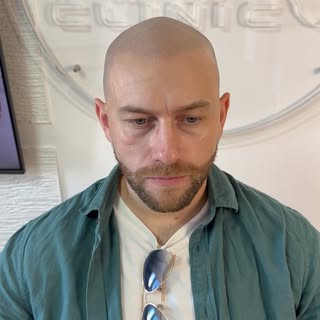 HEALED LOOK — prava vrednost SMP-a

Kod SMP-a rezultat se ne ocenjuje odmah nakon tretmana. Prava pr