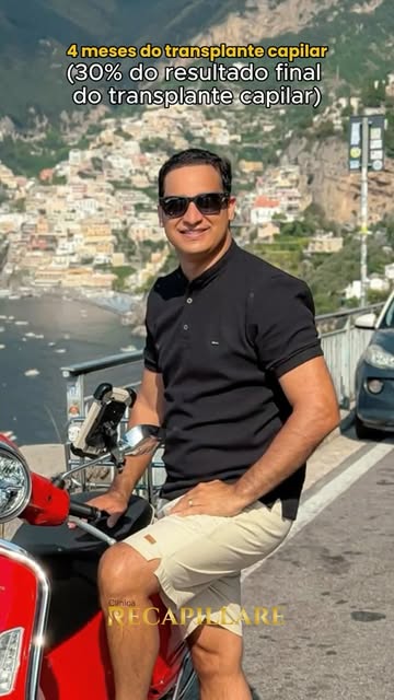 4 meses pós-transplante capilar e um visual novo a tempo da viagem! ✈️

Nosso paciente planejou cada