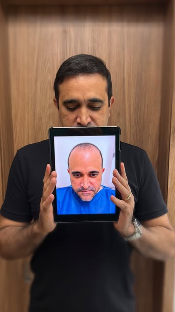 Antes e depois de mais um querido paciente com apenas 10 meses! 🔥🚀

A sua aparência comunica antes