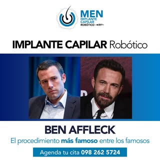 ✨ El implante capilar robótico se ha convertido en uno de los procedimientos más buscados por hombre