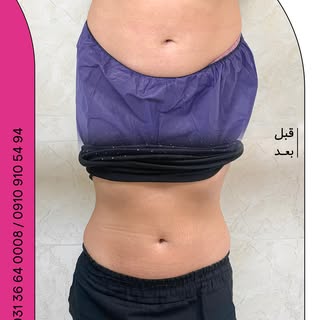 درمان تضمینی چاقی در کلینیک سینایار…🩺💉

جهت مشاوره و اطلاع از قیمت ها کلمه ی (لاغری) را کامنت کنید
