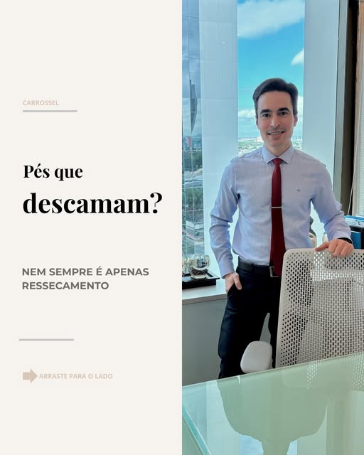 Pés descamando não significam necessariamente “pele seca”.

Micose, dermatite, psoríase, eczema e ou
