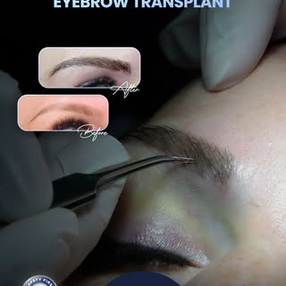 From Belgium to Istanbul for a new journey toward natural looking, beautifully balanced eyebrows. ✨
