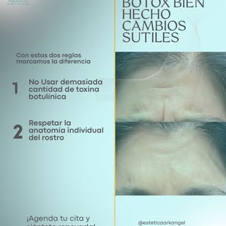 Tu cara no está envejeciendo… está pidiendo ayuda 💉

Las líneas marcan cansancio aunque duermas bie