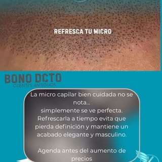 Tu micro capilar te ayudó a verte mejor…
No dejes que el tiempo le quite ese efecto.

El retoque man