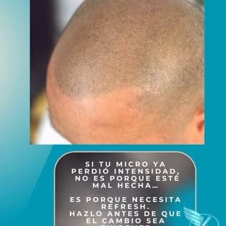 La micro capilar no se trata solo de hacerla…
Se trata de mantenerla impecable ✨

Con el tiempo el p