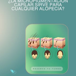 Muchas personas creen que la micropigmentación capilar solo funciona cuando hay pérdida total del ca
