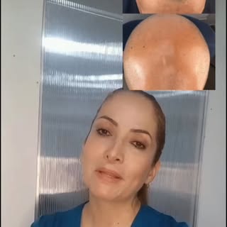 La confianza no siempre se pierde de golpe… a veces desaparece con cada cabello que cae, cada espaci