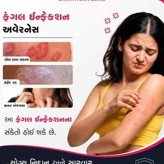 ત્વચા પર ગોળ લાલ ચકામા, સફેદ પડ અથવા સતત ખંજવાળ દેખાય છે? આ લક્ષણો ફંગલ ઇન્ફેક્શનના સંકેત હોઈ શકે છે