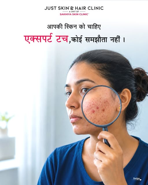 मुंहासे बार-बार लौट रहे हैं और दाग कम नहीं हो रहे? सिर्फ उन्हें कवर करने के बजाय सही कारण जानना ज़रू