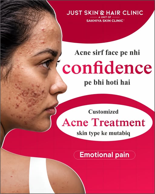 Acne sirf skin ko nahi, confidence ko bhi affect kar sakta hai. ✨ At Just Skin & Hair Clinic, get a 