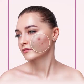 Transform your skin with advanced acne scar treatments like subcision, dermal fillers, and laser the