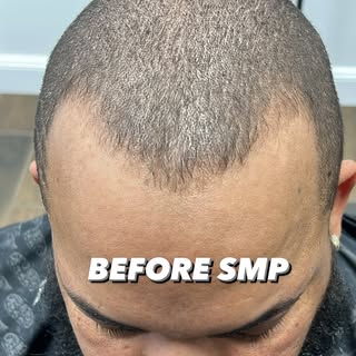 🪄•SECRET TO HAPPINESS IS A GOOD HAIRLINE 

 •TEXT OR CALL (401-263-8463)
 • DM FOR A FREE CONSULTAT