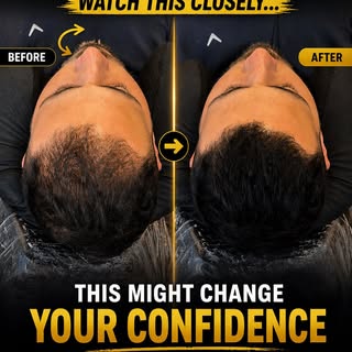 Most people think they’re going bald…
but the truth is they just lost density.

That’s why under cer