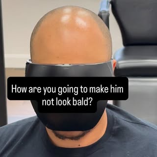 The question isn’t if he’s bald… it’s how we’re going to make him not look bald

#scalpmiropigmentat