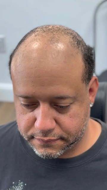 📍 Rhode Island SMP
Did I take 10 years off his look? 👀🔥

This SMP transformation gave him the app