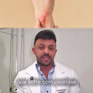 Psoríase não é só uma “irritação na pele”.

É uma doença inflamatória crônica que pode causar descam