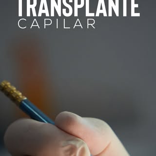 Hoje compartilho com vocês o depoimento do Cris antes de iniciarmos o transplante capilar. Cada paci