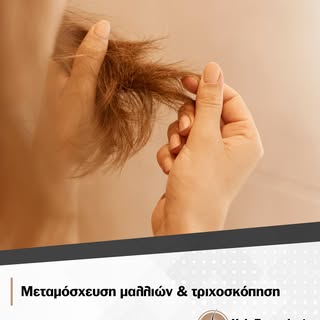 Η τριχόπτωση δεν εμφανίζεται πάντα με εμφανή κενά ή έντονη απώλεια. Συχνά ξεκινά με προοδευτική λέπτ