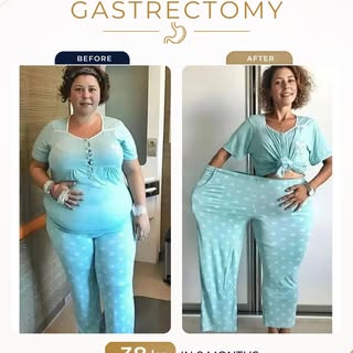 Real patients, real results. 🥰

Our lovely patient Sofia lost 38 in less than 8 months. We are prou