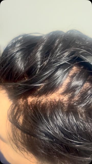🔥 Confira o resultado dessa aplicação Full Lace!

Naturalidade, acabamento impecável e um visual re
