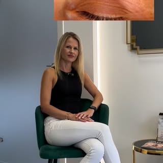 ✨ Transplantácia obočia v Aethra Clinic Istanbul

Riedke, nerovnomerné alebo príliš vytrhané obočie 