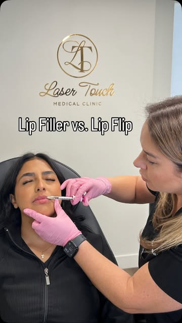 Lip Flip vs. Lip Filler 💋 Which one is right for you?

They may both enhance the appearance of your
