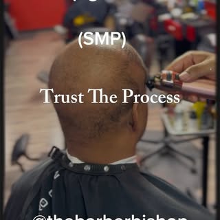 SMP done the right way—strategic placement, natural density, flawless finish.
This is more than hair