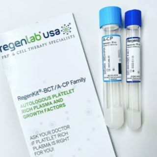 Le traitement par injection de Plasma Riche en Plaquettes (PRP) s'est avéré être une avancée promett