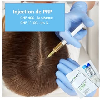 Le traitement par injection de Plasma Riche en Plaquettes (PRP) s'est avéré être une avancée promett
