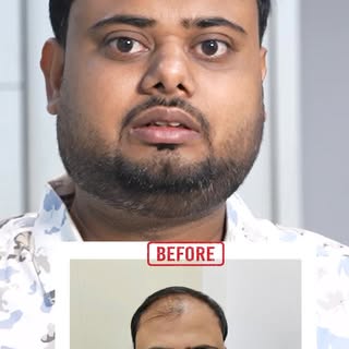 From Bald to Bold. 💪✨
Watch real patients beat baldness and transform their look with Panacea Globa