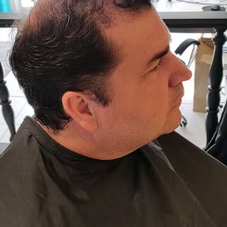 Aparência Renovada! Prótese Capilar.